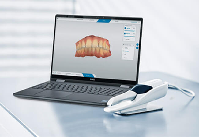 口腔内スキャナー｜Primescan Connect