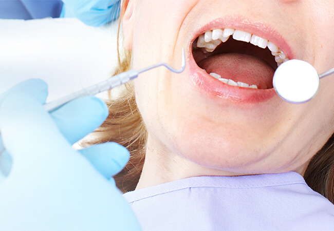 歯周病が進行していないか心配