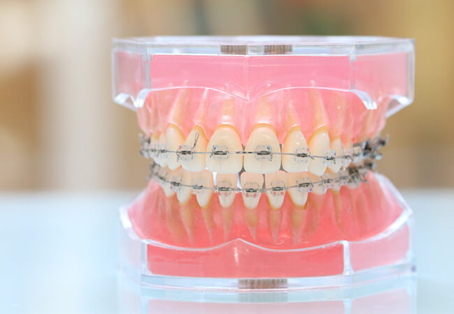 歯並びや噛み合わせが気になる