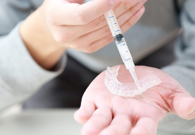 ホームホワイトニング