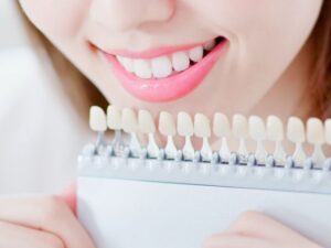 シェードで歯の白さを確認する様子