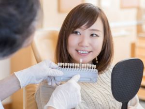 歯の色を見本を当てて確認する様子